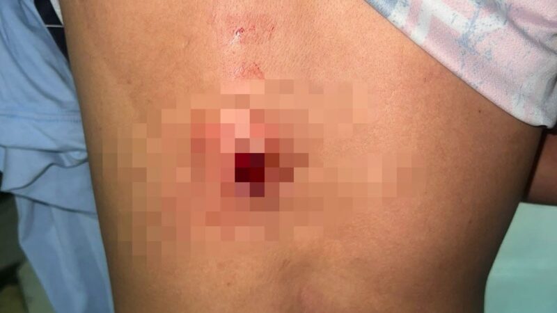 Joven se opuso al robo de su motocicleta y fue herido con arma traumática en el corregimiento  El Centro